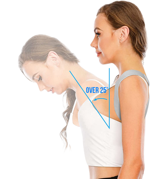 ONAMASTE Posture Corrector på